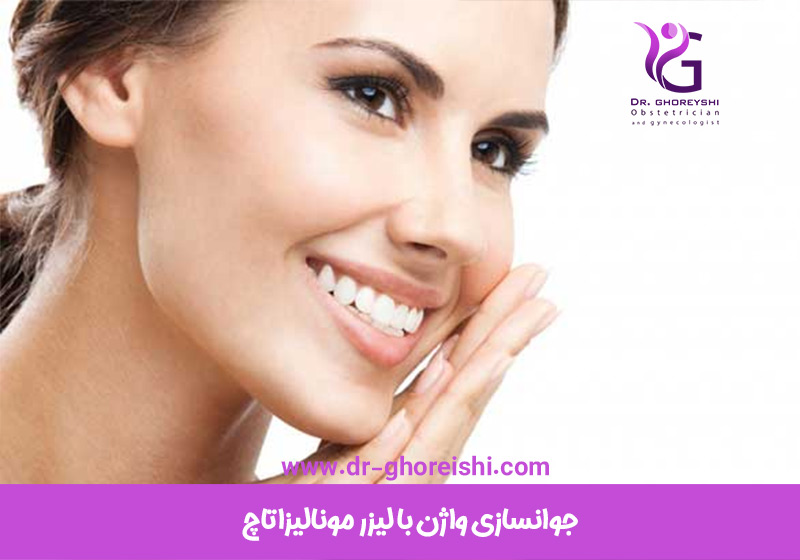 جوانسازی-واژن-با-لیزر-مونالیزاتاچ