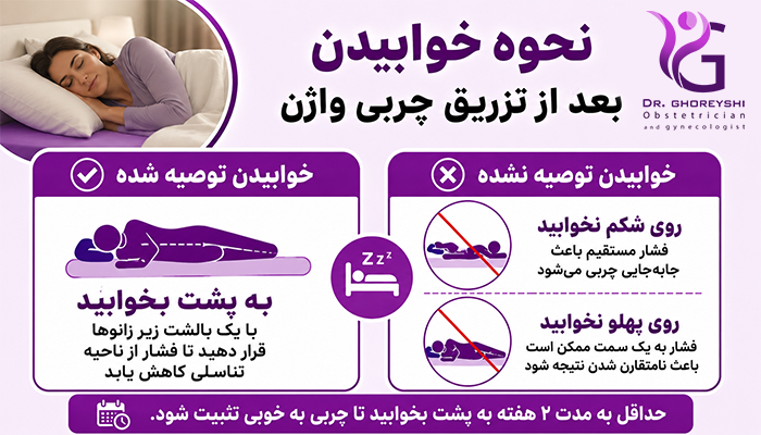 نحوه خوابیدن بعد از تزریق چربی واژن