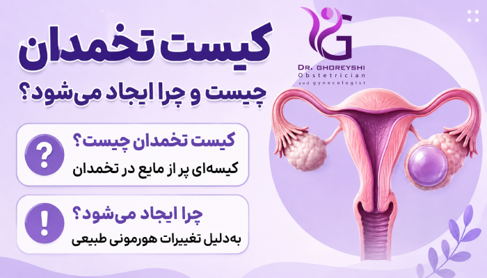 کیست تخمدان چیست و چرا ایجاد میشود؟